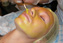 Block�age Peel